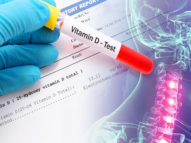 test-na-vitamin-D